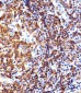HLA-DRB1 Antibody (Center)