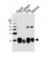 HLA-DRB1 Antibody (Center)