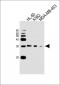 SSPN Antibody (N-term)