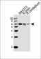 R Prkaa1 Antibody (N-term)