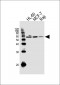 DNAAF8 Antibody (Center)
