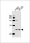 GADD45GIP1 Antibody (N-term)