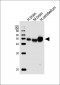 ATP1B2 Antibody (Center)