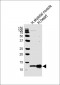 COX6A2 Antibody (Center)