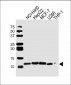 RPS21 Antibody (C-term)