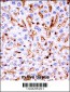 Mouse Mapk11 Antibody (N-term)