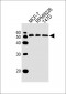 ZDHHC11 Antibody (C-term)