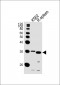 SLC25A37 Antibody (C-term)