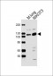 Mouse Ddr2 Antibody (Center)