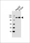 MTTP Antibody (C-term)
