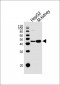 DNASE1 Antibody (Center)