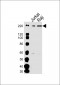 DOCK2 Antibody (C-term)