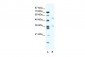 BTBD3 antibody - middle region