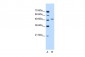 SEMG1 antibody - N-terminal region