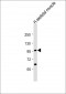 YY1AP1 Antibody (Center)