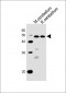 Mouse Pax6 Antibody (C-term)
