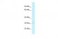 RPA2 antibody - N-terminal region