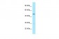 UQCRC2 Antibody - C-terminal region