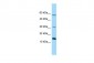 NDUFB4 Antibody - C-terminal region