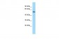 RTN4RL1 Antibody - middle region