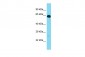 GPR162 Antibody - N-terminal region