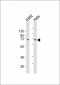 ZNF257 Antibody (C-term)