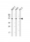 PPP2R5E Antibody (C-term)