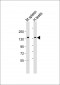 BCL9 Antibody (N-Term)