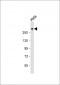 TPR Antibody (C-term)