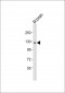 Mouse Abl2 Antibody (C-term)