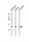 MTCP1 Antibody (C-Term)