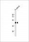 WNT7A Antibody