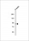 RAD54B Antibody (N-term)