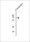 UGT2B4 Antibody (Center)