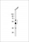 UGT2B4 Antibody (Center)