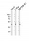 UGT2B4 Antibody (Center)