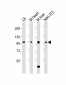 Mouse Insr Antibody (P1325)