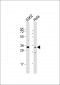 PRSS21 Antibody (N-Term)