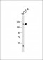 SOS1 Antibody (Center)