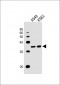 RHOXF2B Antibody (Center)