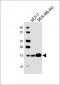 CRABP2 Antibody (C-term)