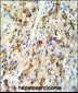 CECR5 Antibody (Center)