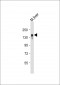 ABCB11 Antibody (C-term)