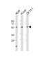 PM20D1 Antibody (N-Term)