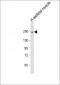 MYH2 Antibody (N-Term)