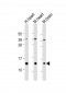 NDUFB3 Antibody (Center)