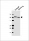 Mouse Gpi Antibody(C-term)