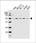 GTF2E1 Antibody (N-term)