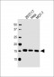 UBE2D3 Antibody (C-term)