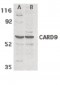 CARD9 Antibody (aa521-536)